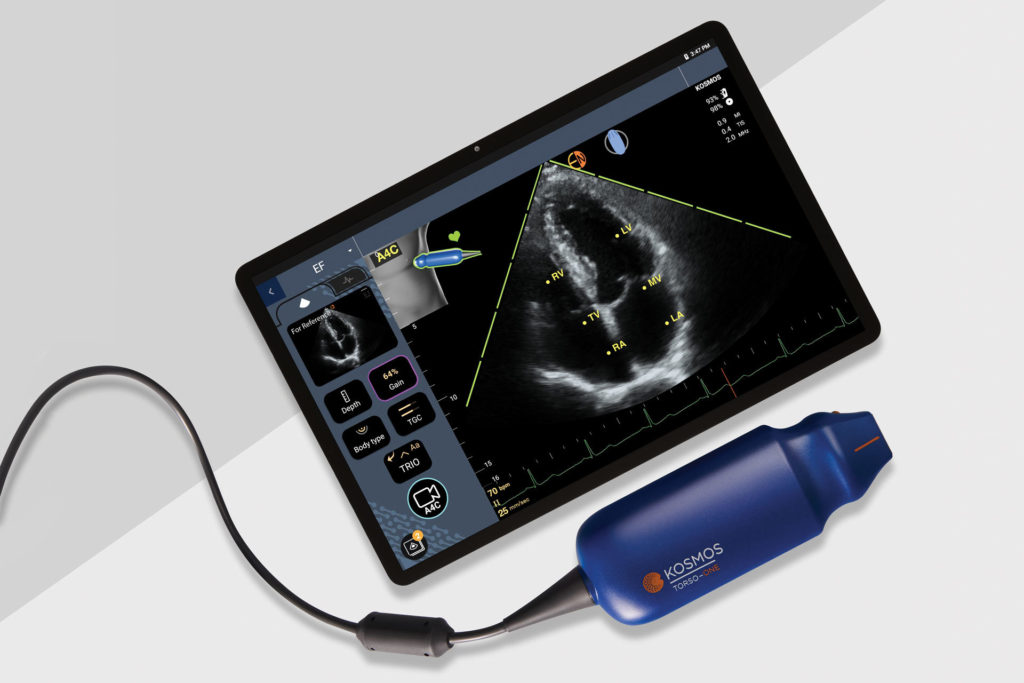 Point of Care Ultrasound Technology (POCUS) With AI