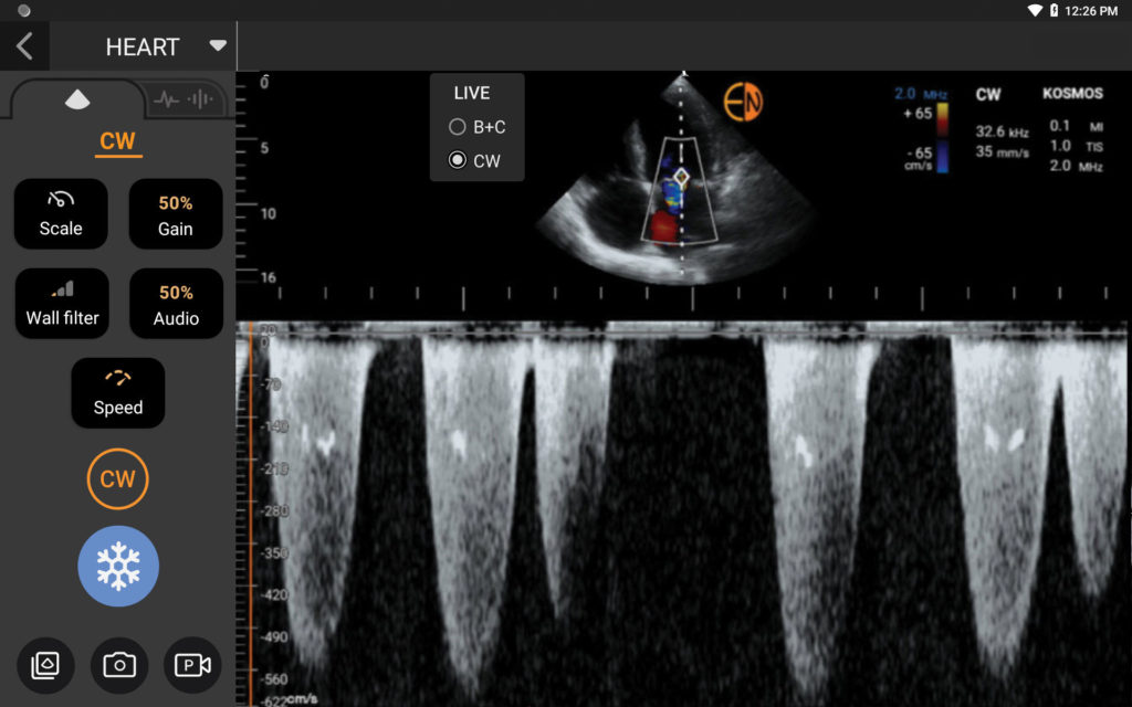 Kosmos CW Doppler