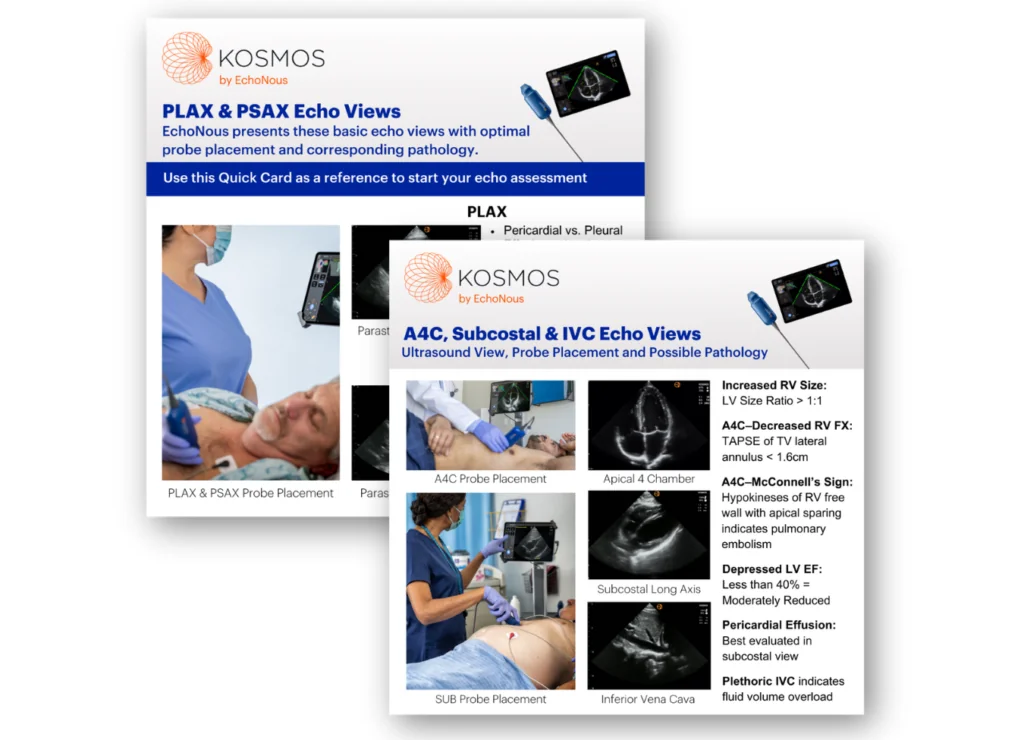 Clinical Card showing PLAX & PSAX Echo Views and A4C, Subcostal & IVC Echo Views