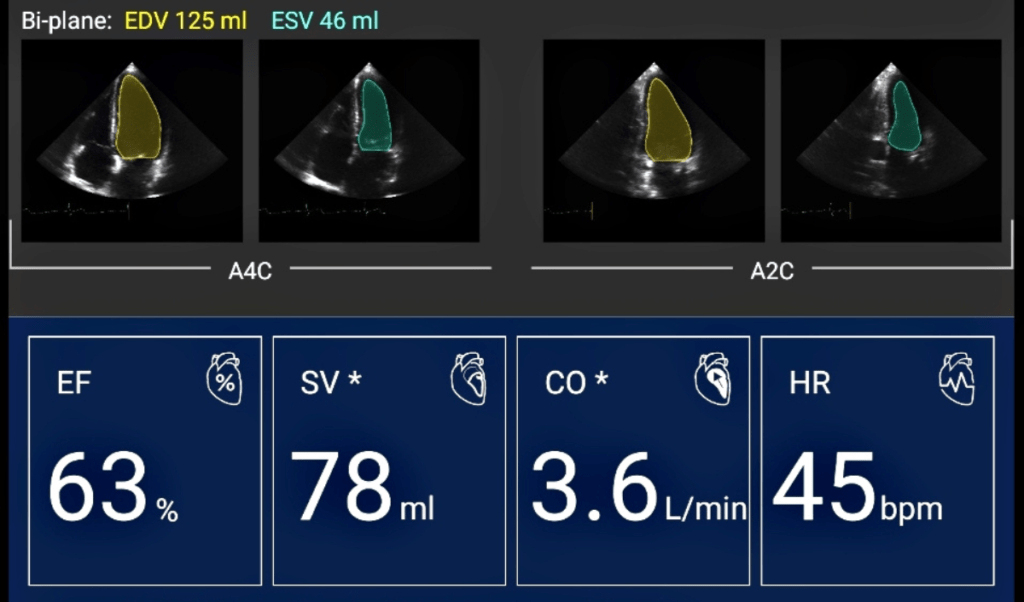 Kosmos Bridge, AI-assisted EF Workflow