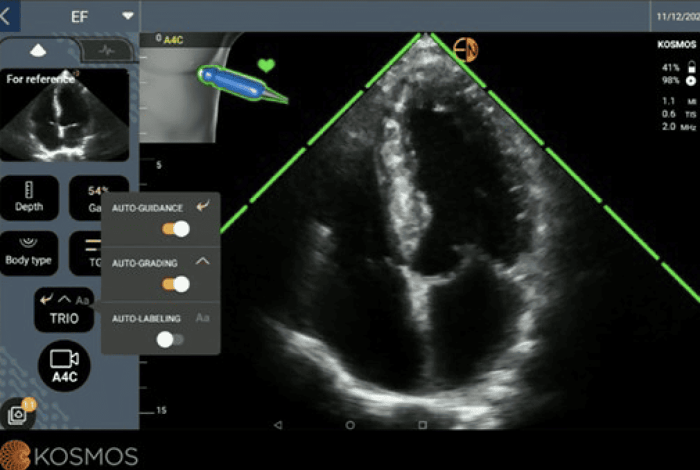 Kosmos AI-assisted EF workflow