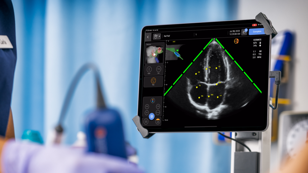 Kosmos leverages proprietary deep learning algorithms to help novice users learn ultrasound quicker and to streamline workflows for experts.