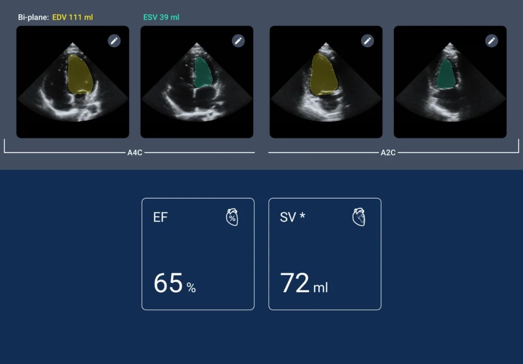 Ejection Fraction Report