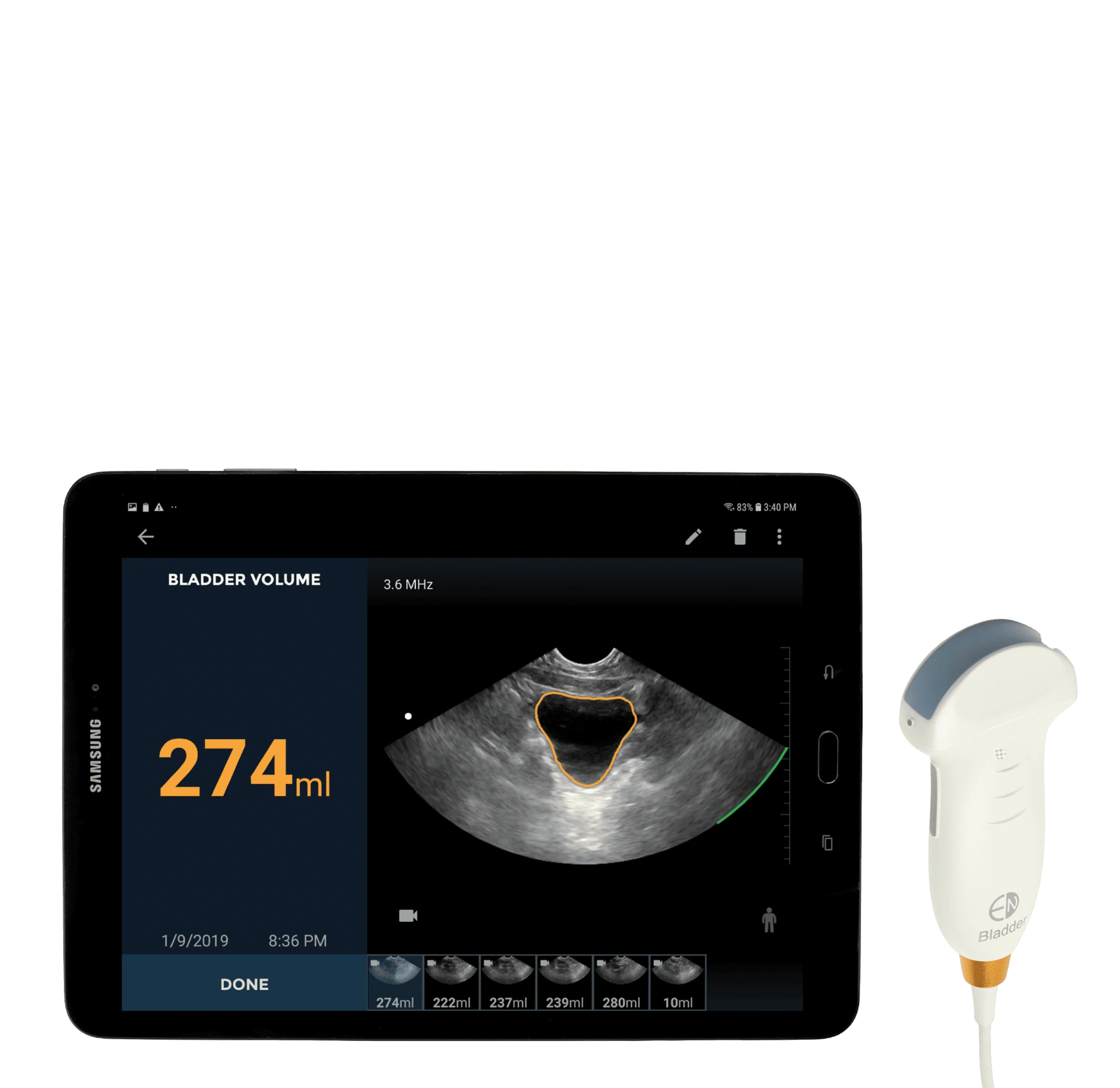 EchoNous Bladder- A highly reliable, all-electronic, non-mechanical bladder tool designed to improve durability