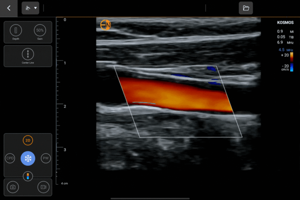 Carotid Artery on Kosmos for Apple iOS and Android