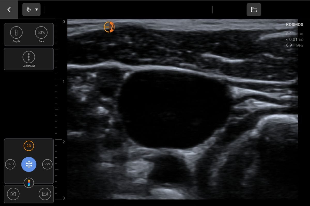 Internal Jugular Carotid on Kosmos for Apple iOS and Android