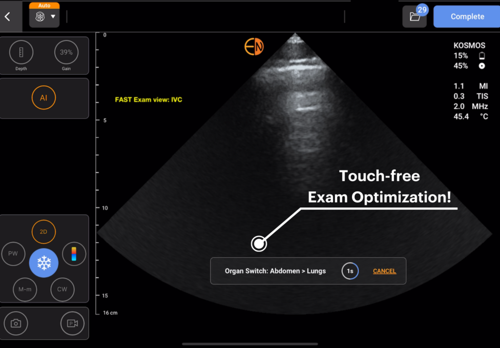 Auto Preset is an intelligent feature that seamlessly adjusts the exam preset in real time as the user scans different anatomies. Whether transitioning from scanning the abdomen to scanning the lungs or heart, the system intuitively switches to the appropriate preset, ensuring optimal imaging without manual intervention. This feature is especially beneficial for new users, ensuring that they operate under the preset that will give them optimal image clarity