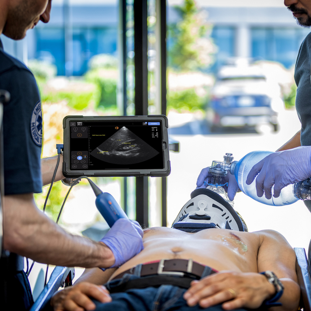In emergency medicine, POCUS plays a vital role in trauma by enabling rapid assessment using the FAST (Focused Assessment with Sonography for Trauma) protocol to detect free fluid and organ injuries. During cardiac arrest, it helps evaluate cardiac activity and volume status during CPR. It is also essential in quickly detecting and managing conditions like pulmonary edema and pneumothorax.