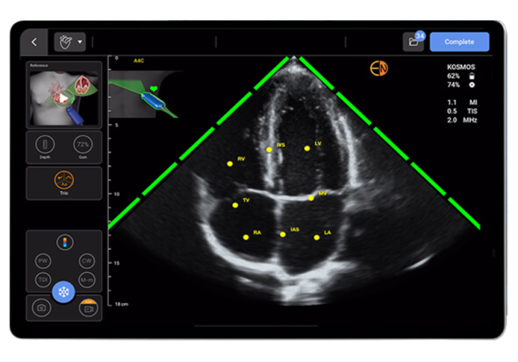 Kosmos Trio- Guidance, Grading, and Labeling of the cardiac anatomy