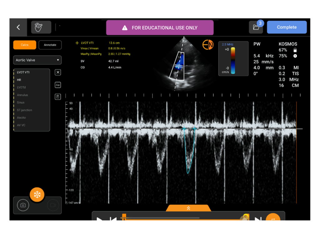 Kosmos EDU- PW Doppler