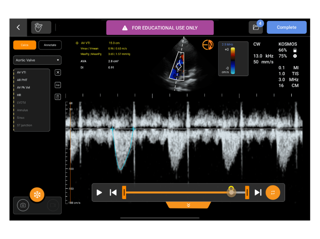 Kosmos EDU- CW Doppler