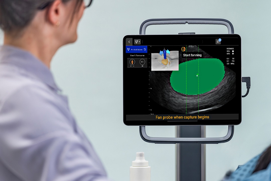 EchoNous Introduces Kosmos Bladder: Unmatched Accuracy and AI-Driven Precision Redefine Bladder Volume Scanning