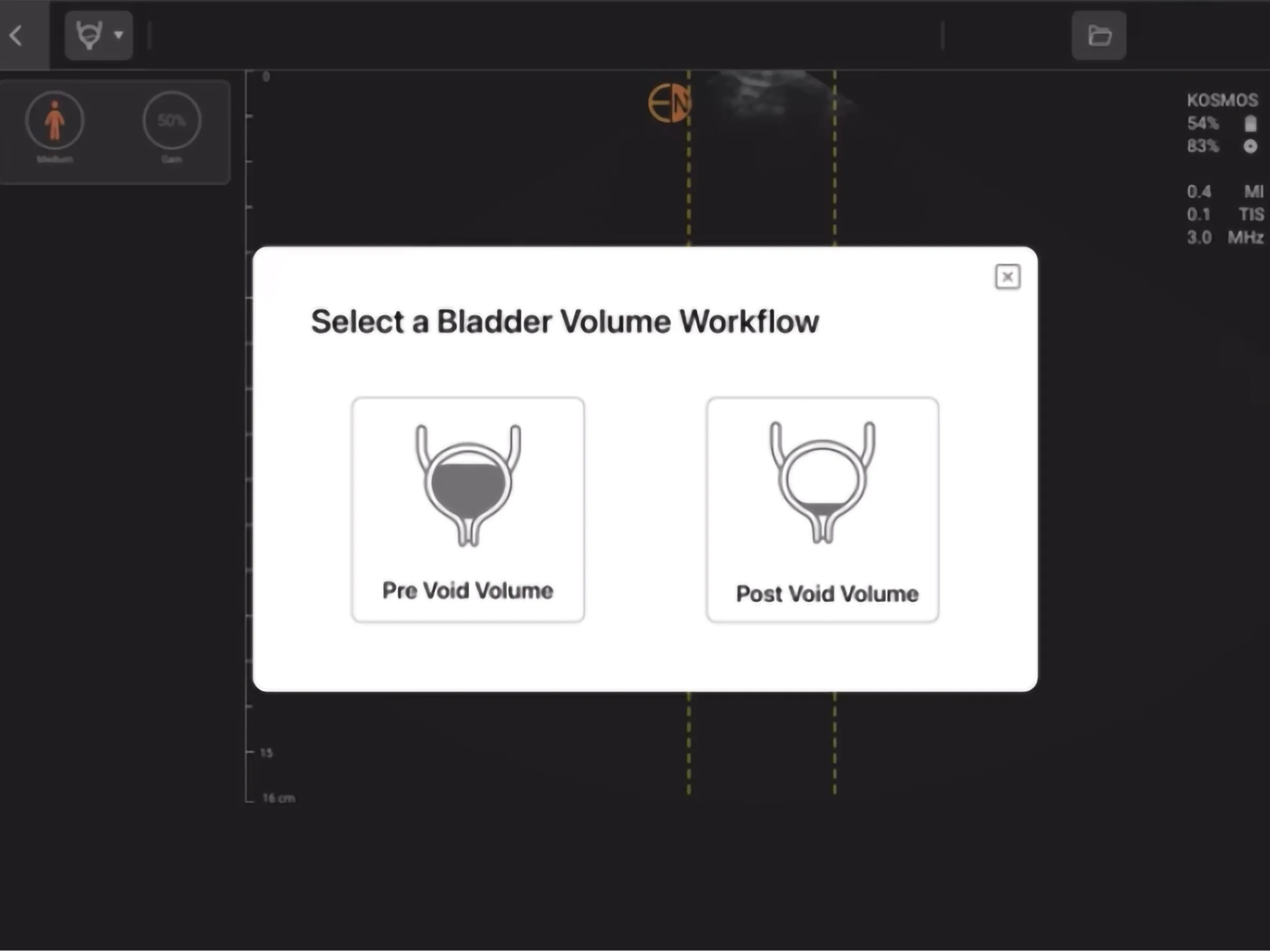 Bladder Volume Workflow Selection