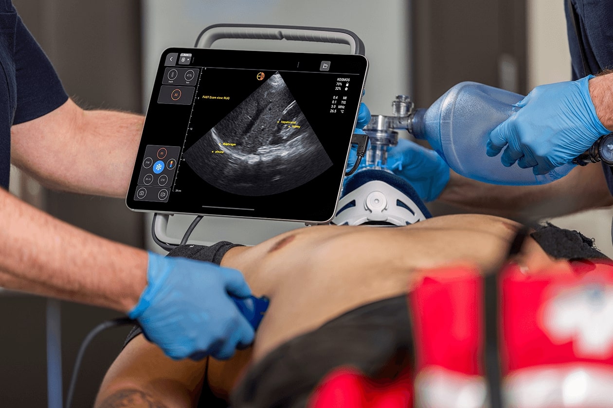Kosmos by EchoNous leveraging cutting-edge deep learning algorithms to transform the way clinicians assess heart, lungs, and abdomen in minutes