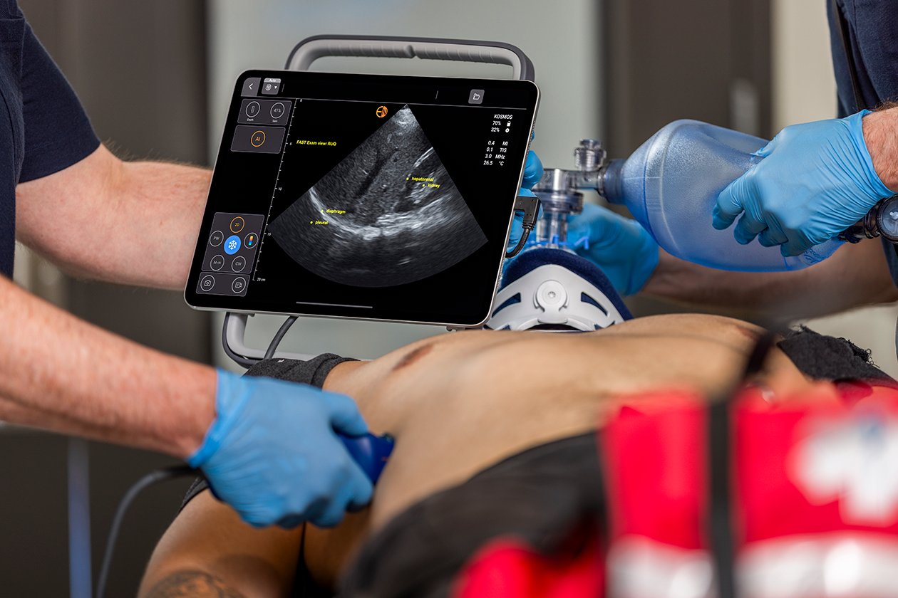 Kosmos by EchoNous leveraging cutting-edge deep learning algorithms to transform the way clinicians assess heart, lungs, and abdomen in minutes
