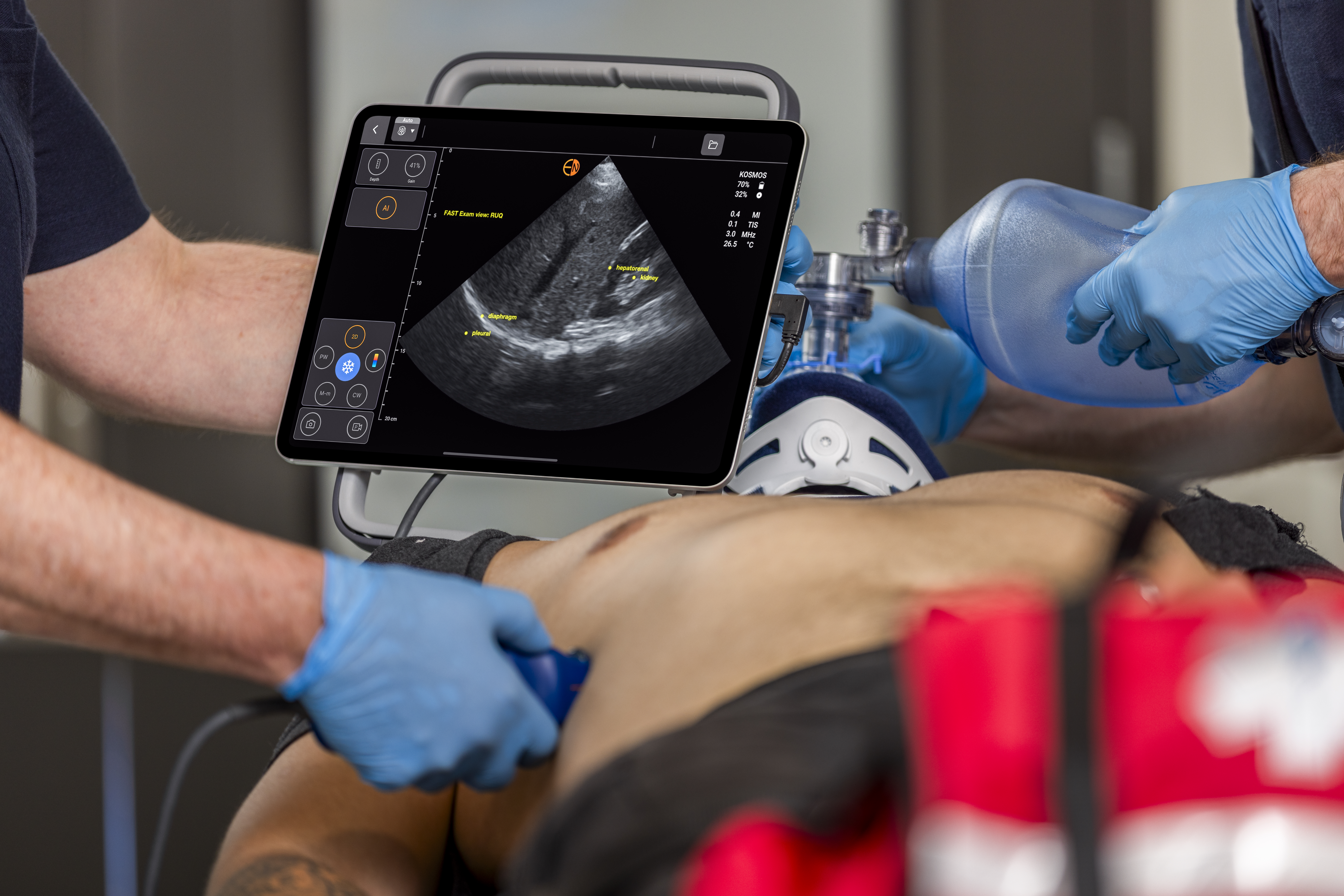 Kosmos by EchoNous leveraging cutting-edge deep learning algorithms to transform the way clinicians assess heart, lungs, and abdomen in minutes