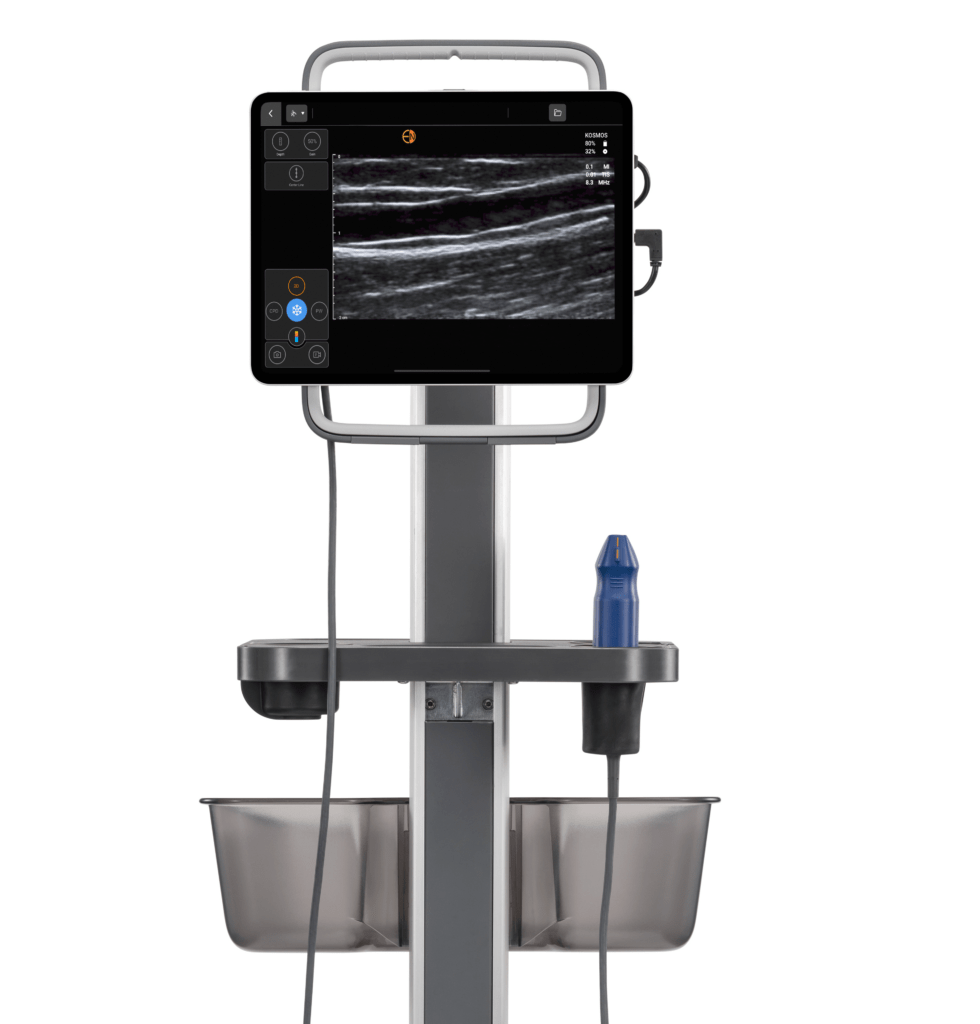 Kosmos Vascular Access solution showing Cephalic Vein