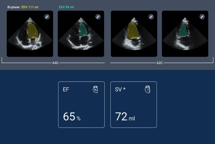 Kosmos Auto EF results screen