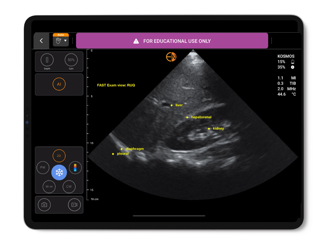 AI FAST on Kosmos EDU