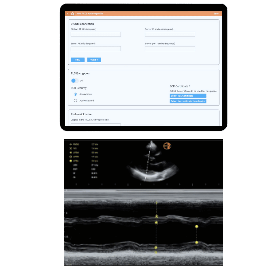 Kosmos DICOM and M-mode Cardiac Calcs
