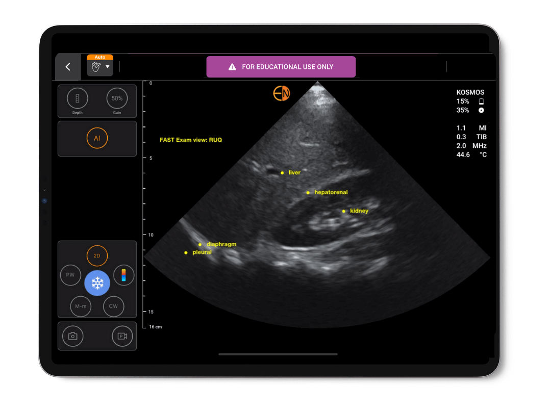 AI FAST on Kosmos EDU