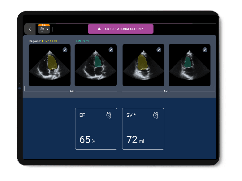 Auto EF on Kosmos EDU