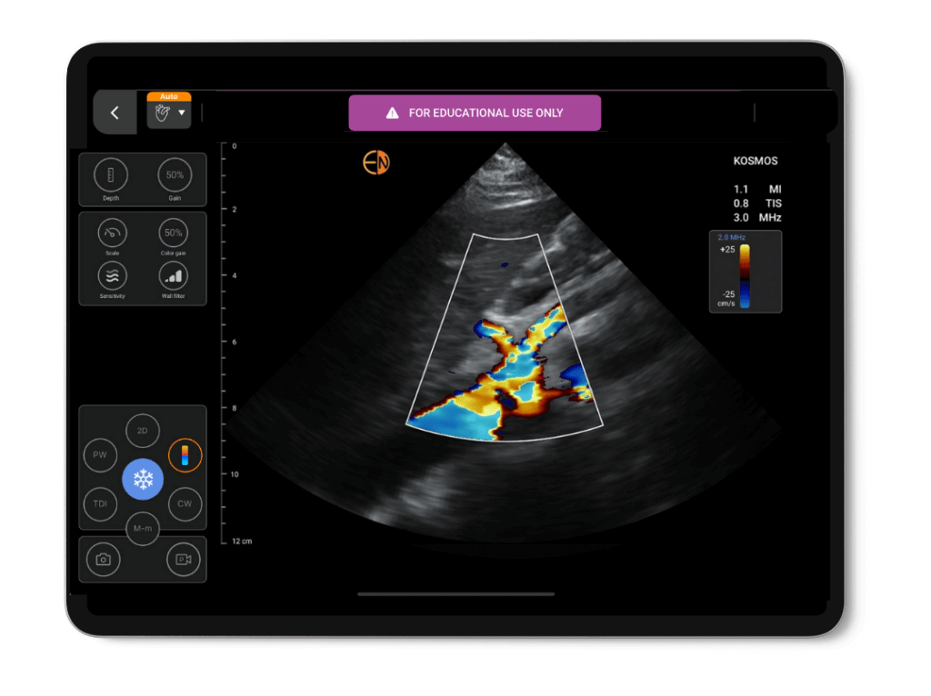 Color Doppler on Kosmos EDU