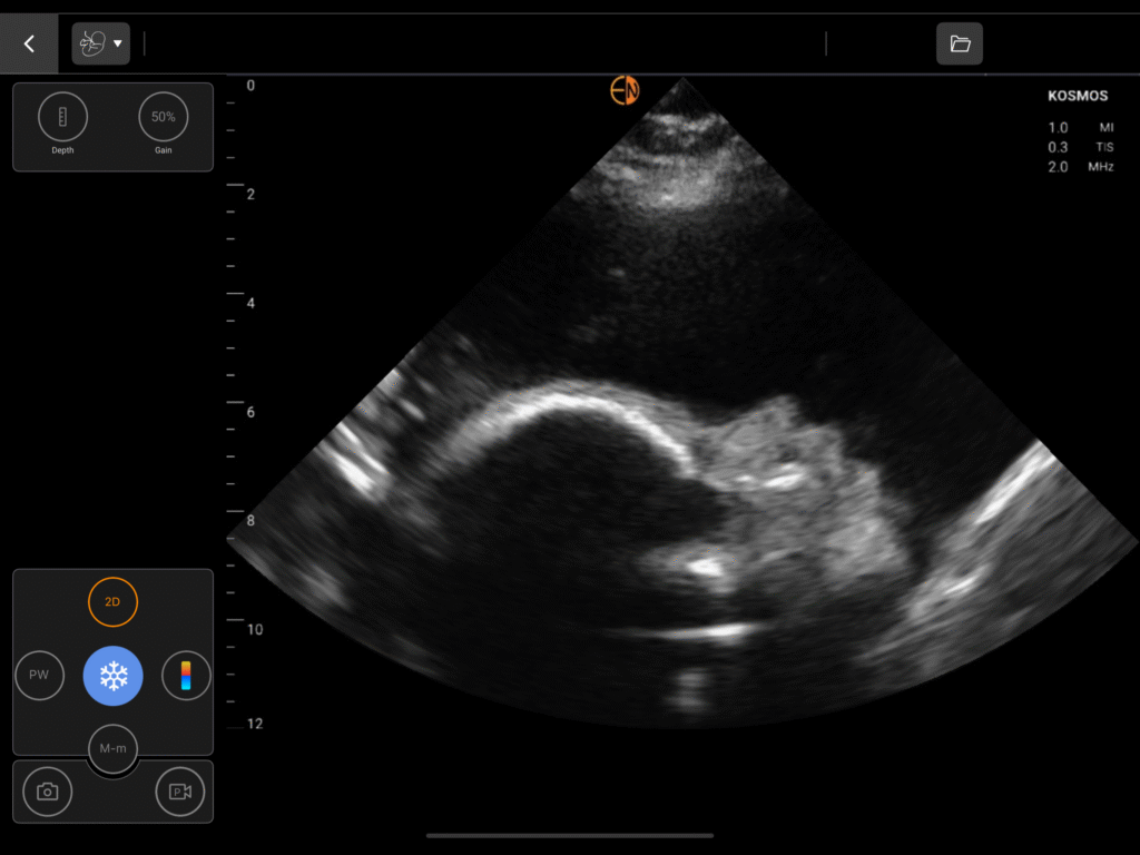 OB Profile image on Kosmos