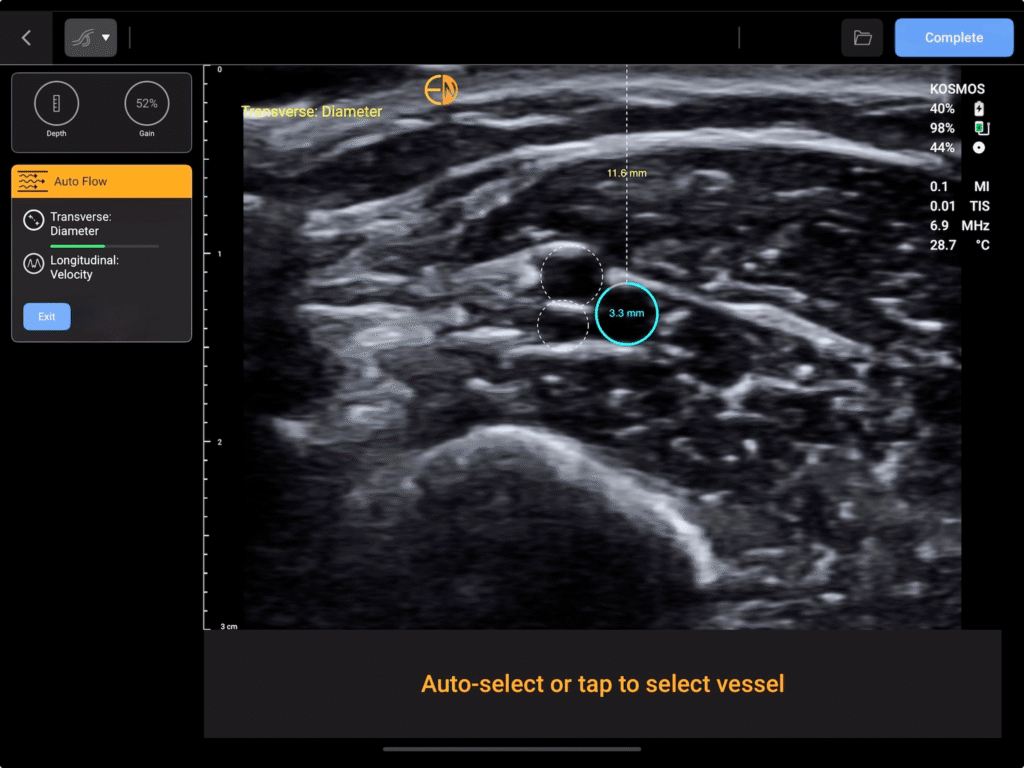 Kosmos VAF- Automatic vessel detection with instant diameter and depth in the transverse plane