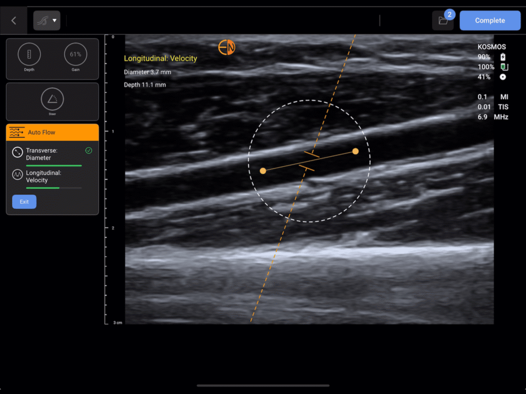 Kosmos VAF- Automatic Doppler gate placement & optimization
