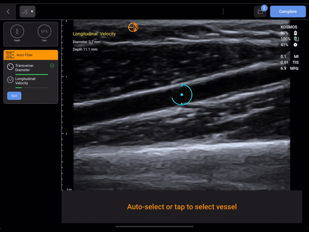 Kosmos VAF- Automatic vessel detection in the longitudinal plane
