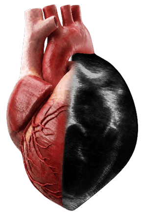 half image of a heart anatomy and the other half is the ultrasound image of the heart.